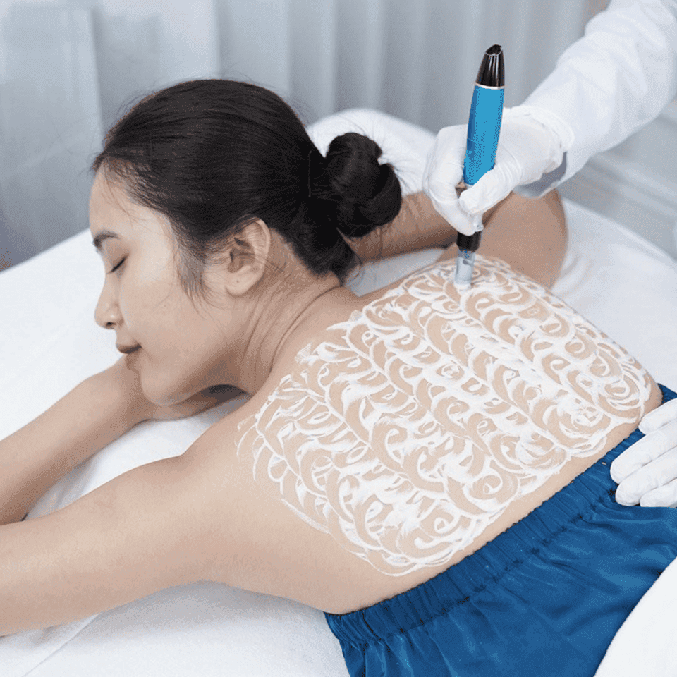 Bước điều trị 3